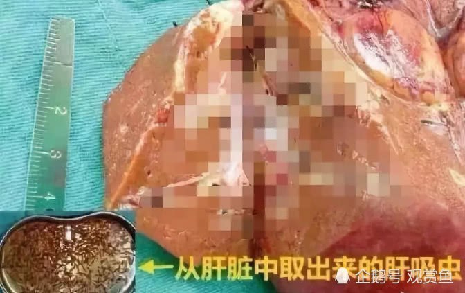 Hangtai Aquarium: eating sashimi causes hundreds of parasites in the liver