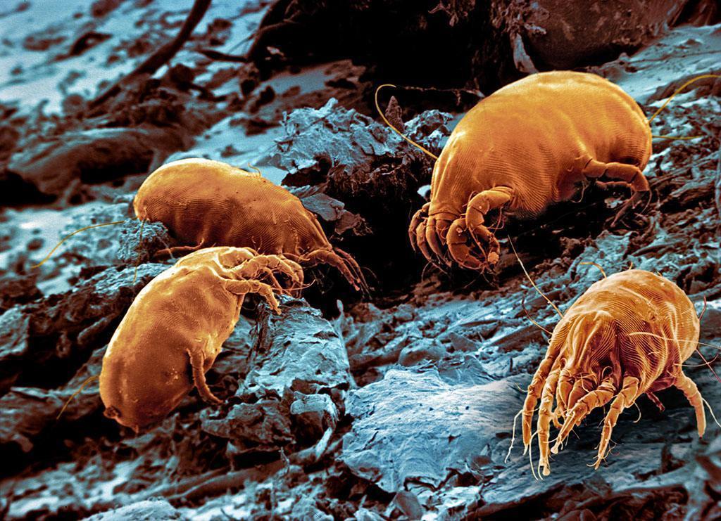 The mites on the pillowcase can't sleep well at night? Maybe it has something to do with it.