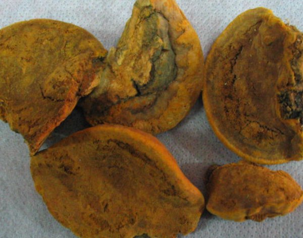 The anti-tumor effect of mulberry yellow may be stronger than that of Ganoderma lucidum.